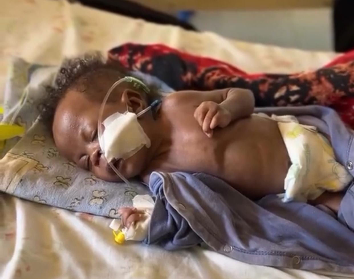 Emergency medical surgery to save Alice 