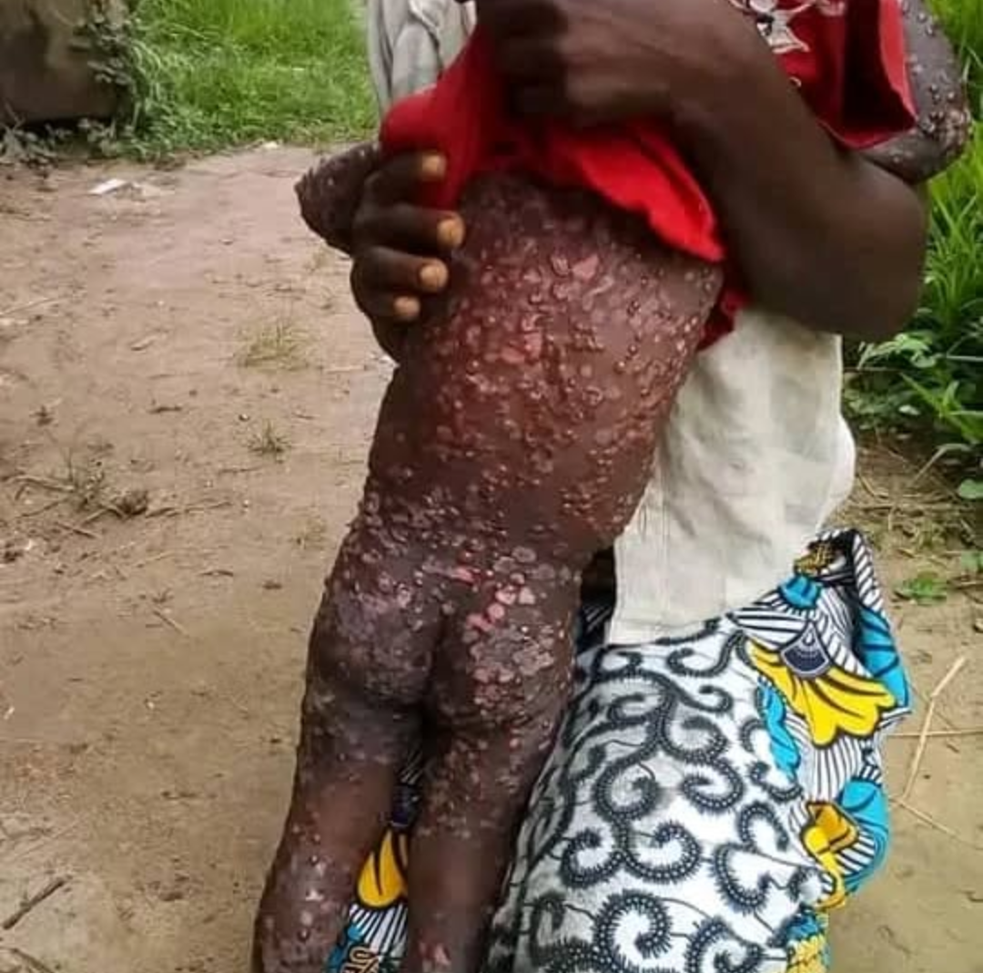 Healing Hearts, Healing Lives.