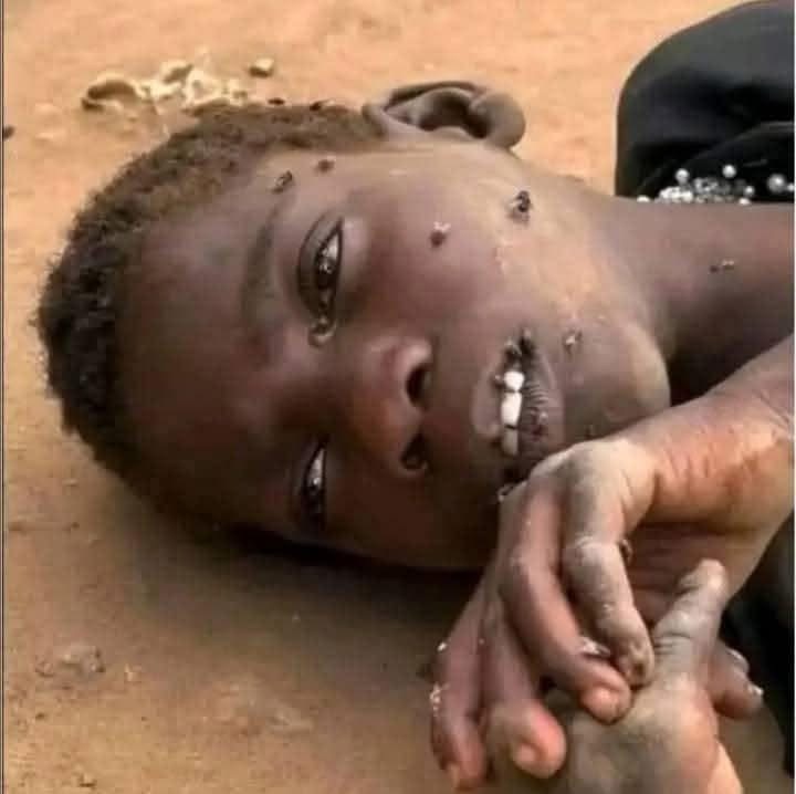 Hundreds of our children die because of the lack of food purchases children In Dafour Al-Fasher