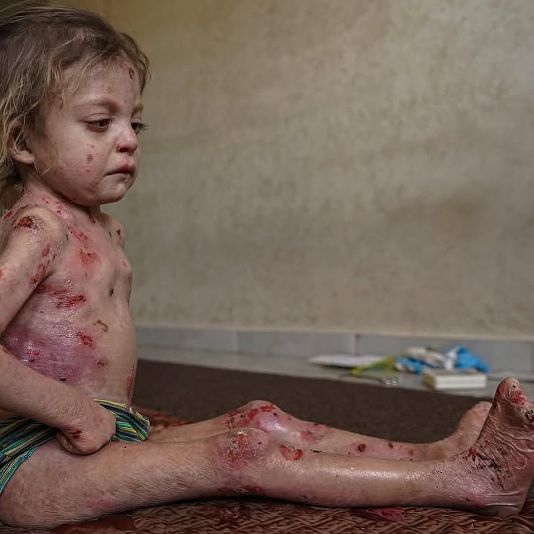 SAVE POOR  HOMELESS FAMILIES IN GAZA 