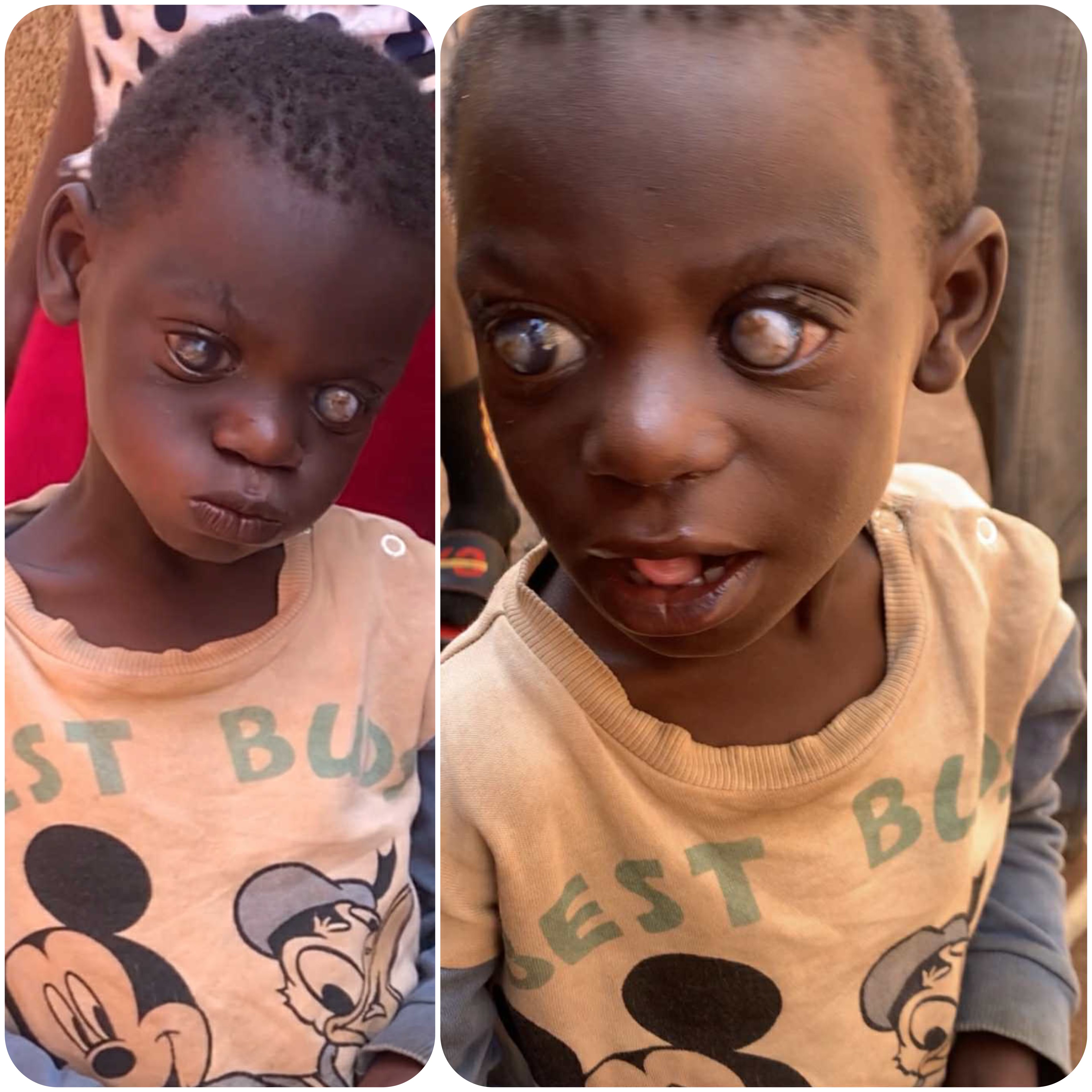 Ngobi Urgently Needs Medical Care & attention