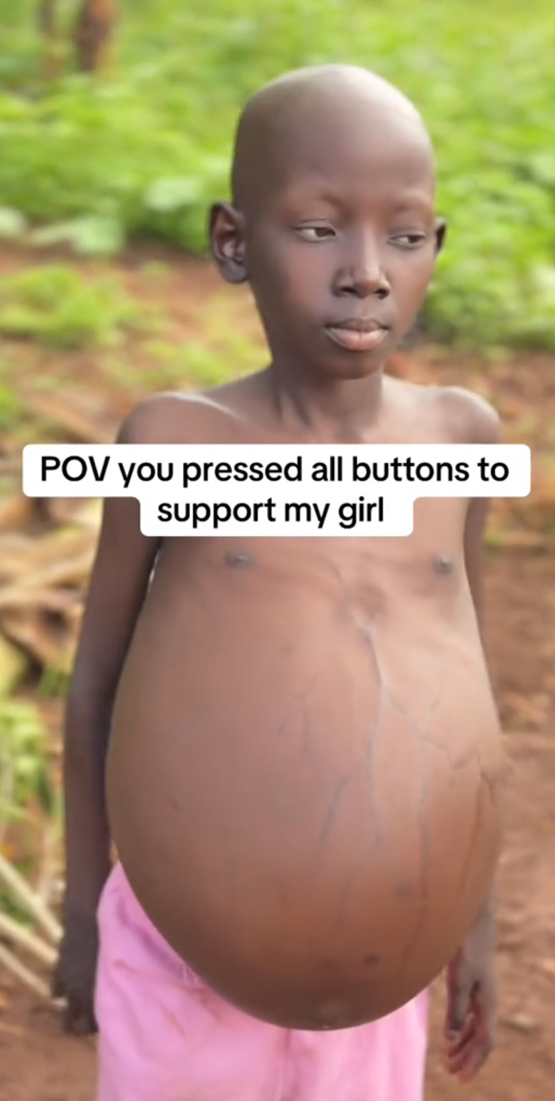 FUNDRAISING CAMPAIGN FOR ROBERTA TREATMENT FOR KWASIOKOR